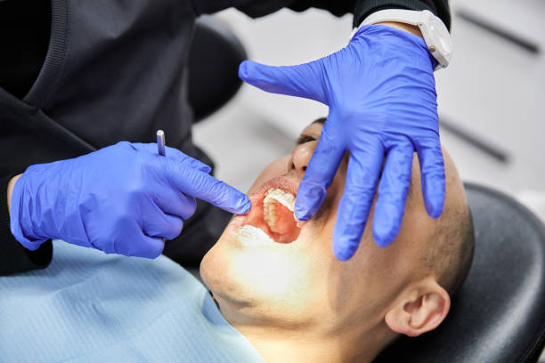 Best Broken Tooth Emergency  in Saint Johns University, MN